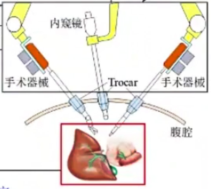 腹腔鏡手術(shù)機(jī)器人結(jié)構(gòu)設(shè)計原理—AIP艾普